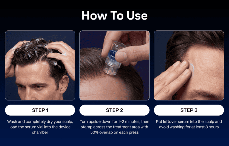 Follifusion Hair Growth System
